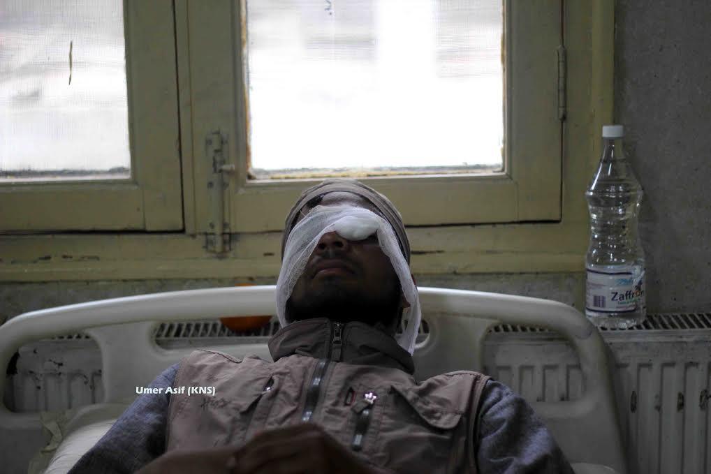 Two youth injured by pellets in Khrew