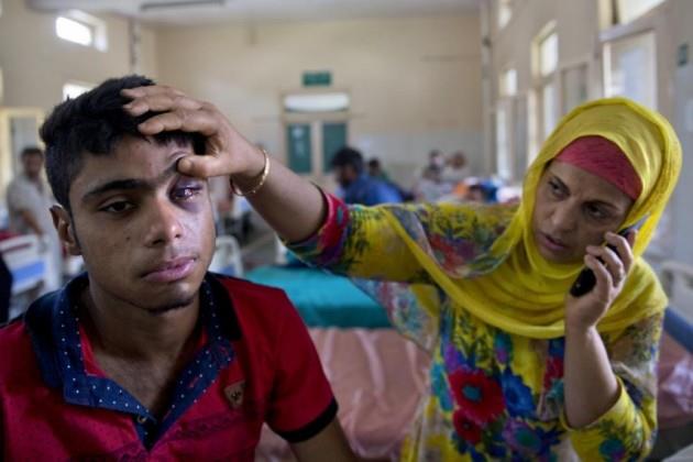 Most of pellet hit victims under age of 20