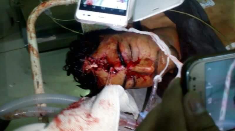 Youth shot dead in Batamaloo