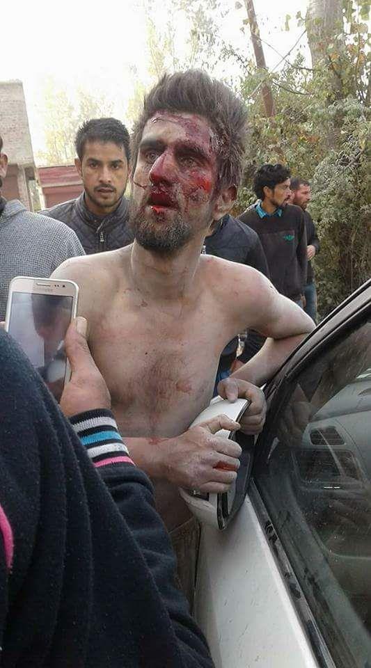 Mistaken as braid chopper, ‘mentally unfit man’ ruthlessly beaten in Sopore