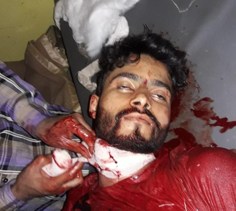 Youth killed in forces firing in Trehgam Kupwara