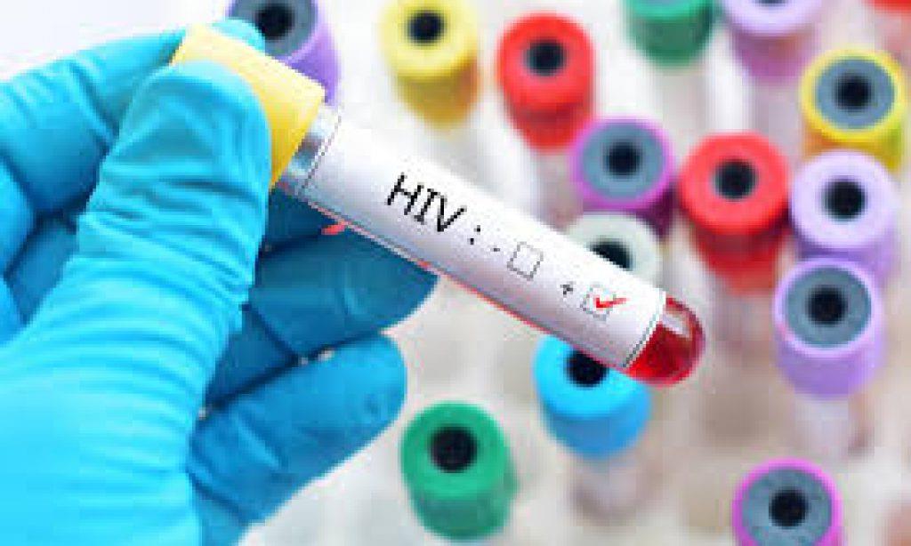 4609 HIV-positive patients in JK, 179 kids below age of 15 also registered