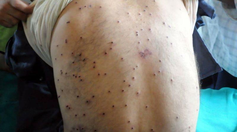 Nine youth sustain pellet injuries during clashes in different areas