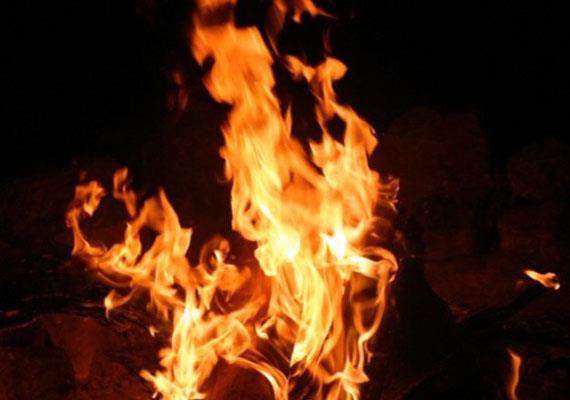 Woman set on fire by in-laws in Anantnag