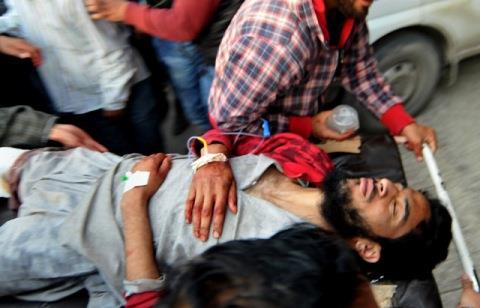 Three injured youth from Nutnussa are stable: SMHS