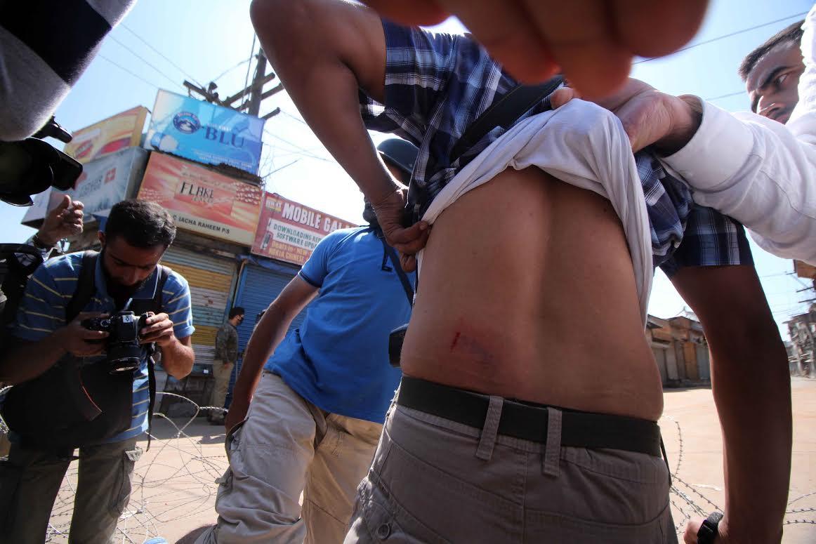 Police beats photojournalists with canes in Batmaloo