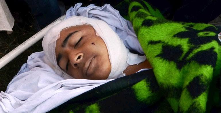 Pellet hit Junaid succumbs to his injuries at SKIMS