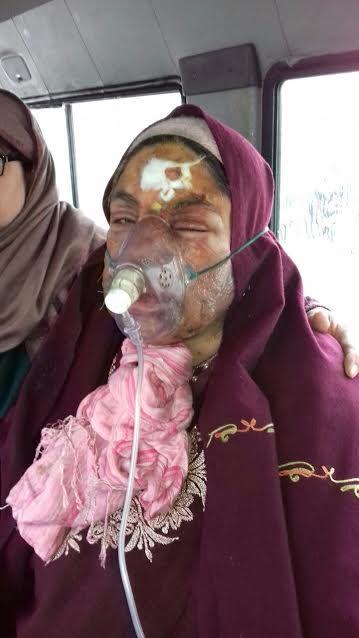 Woman burnt alive at Reshi pora, Police register case