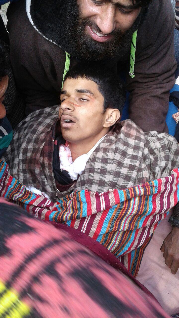 2 militants, civilian killed in Pulwama encounter: Police