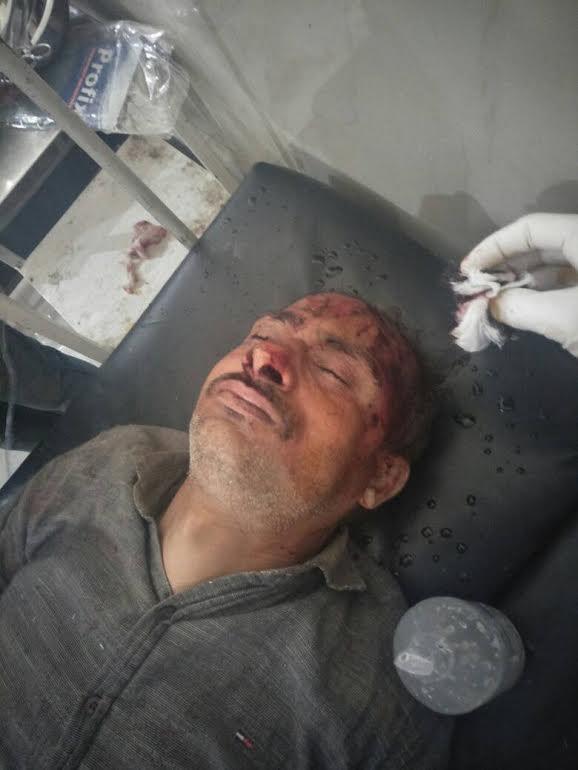 Two died, one injured in Doda road accident