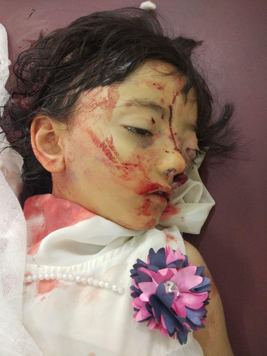 Road accident kills baby girl, mother critical