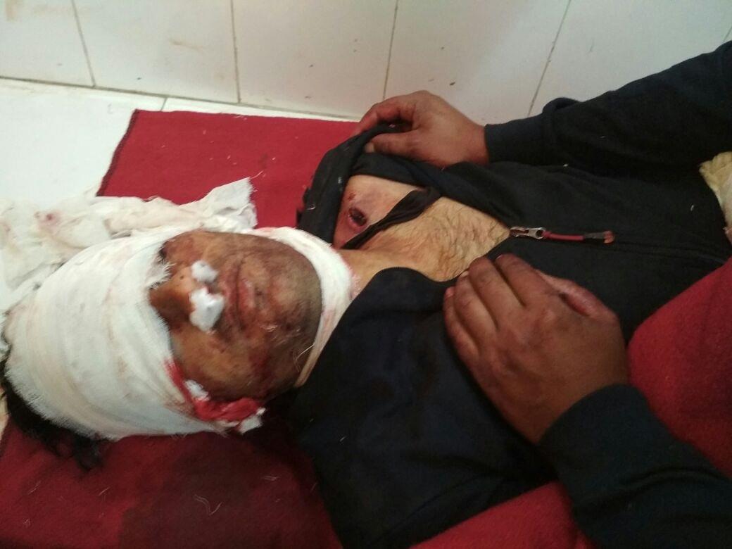 Retired BSF Man shot dead in Hajin Bandipora