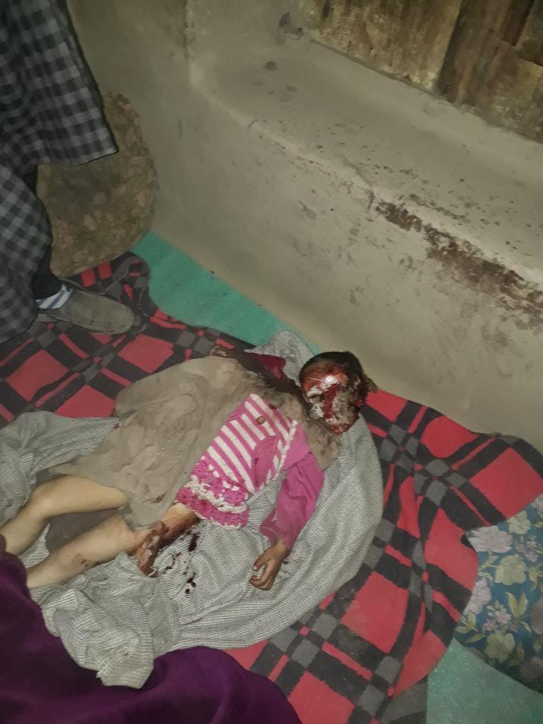 5-year-old girl killed in leopard attack in Kulgam
