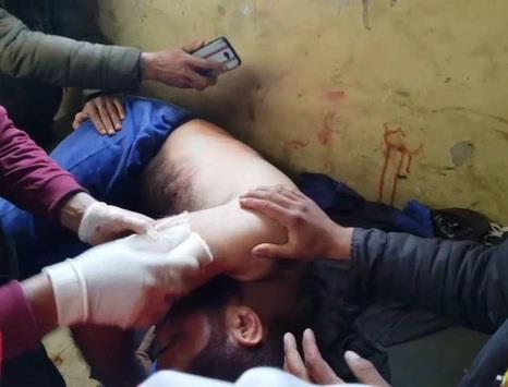 Civilian, cop injured in Shopian militant attack