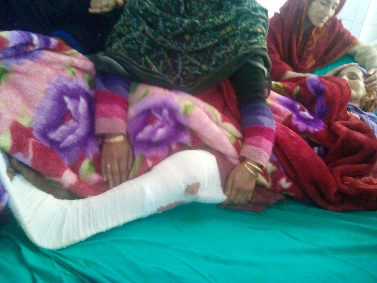 Fifty houses damaged, woman injured in cross LoC fire at Tanghdar