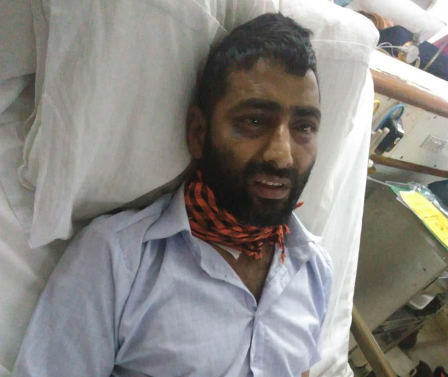 Rs 20,000 compensation for two damaged kidneys a biggest mockery: Chairman IFJHR Ahsan Untoo