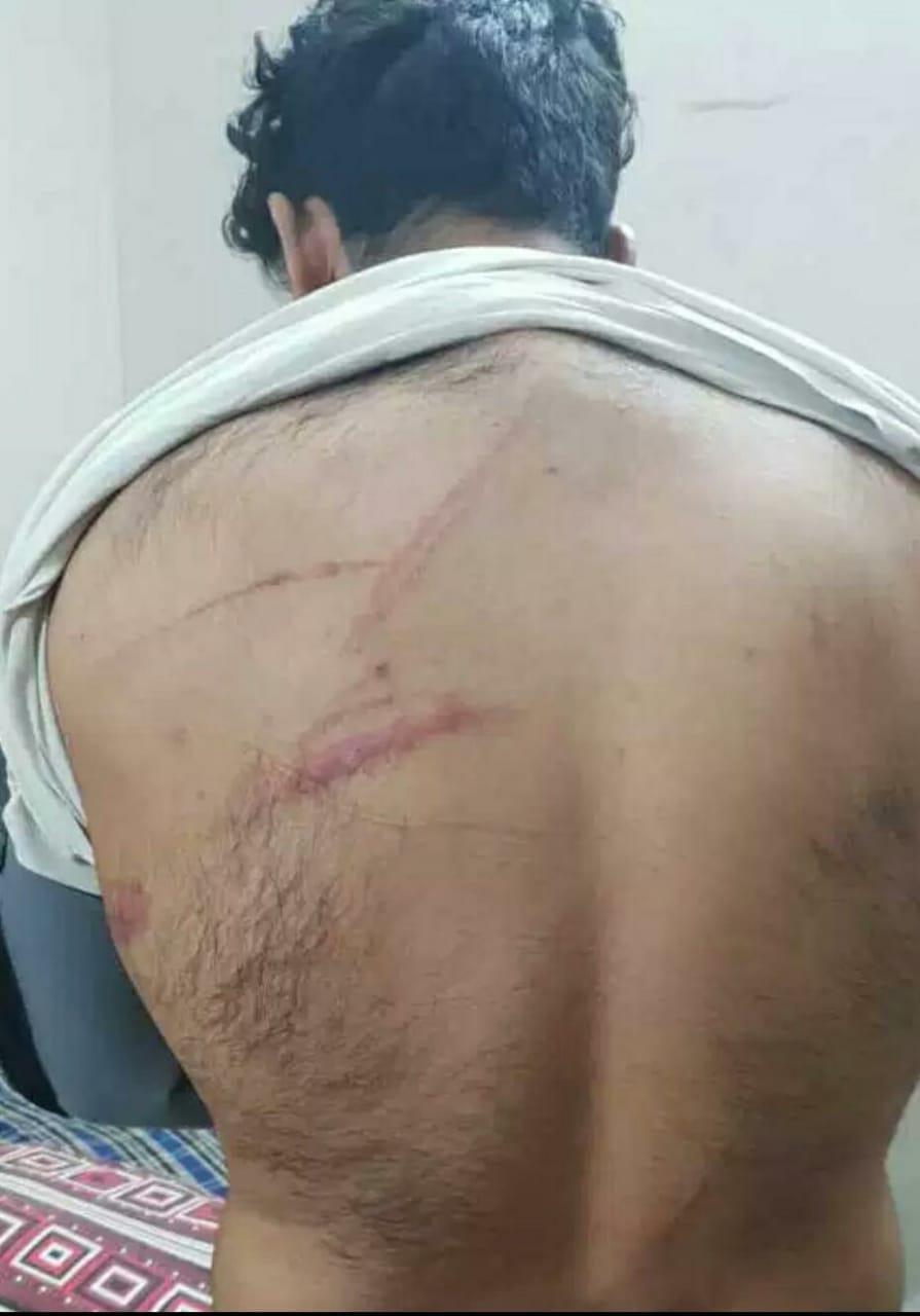 Kashmiri student beaten in Chandigarh, sustains injuries