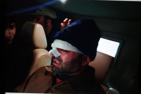 Dy Mayor injured after being assaulted during councilors session