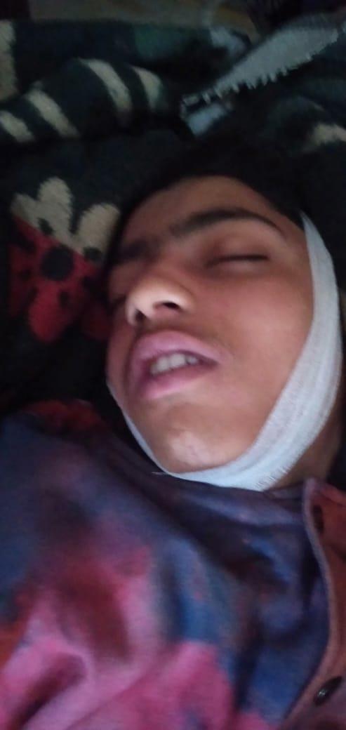 Shopian youth dies due to suffocation