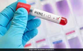 Swine flu: 23 died till date, 6 admitted at SKIMS