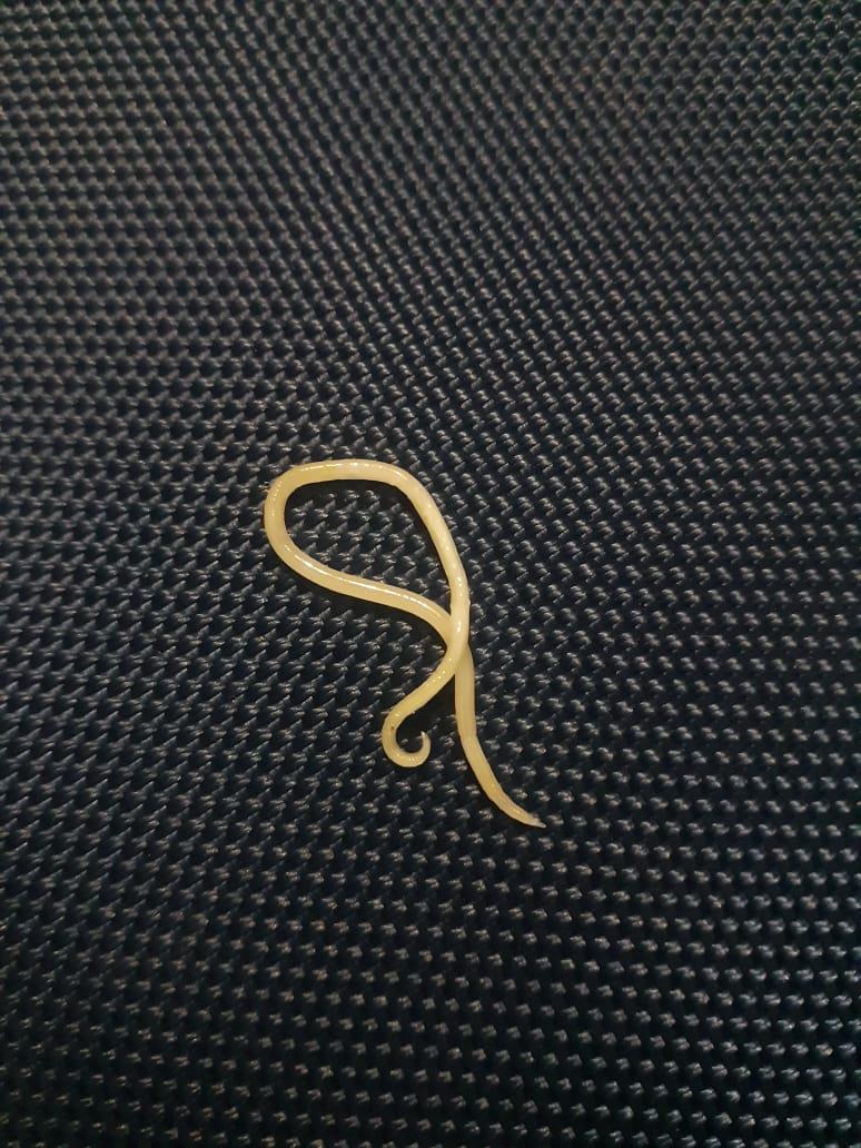 Worm plucked out from eye of a ten-month-old girl in CHC Hajin
