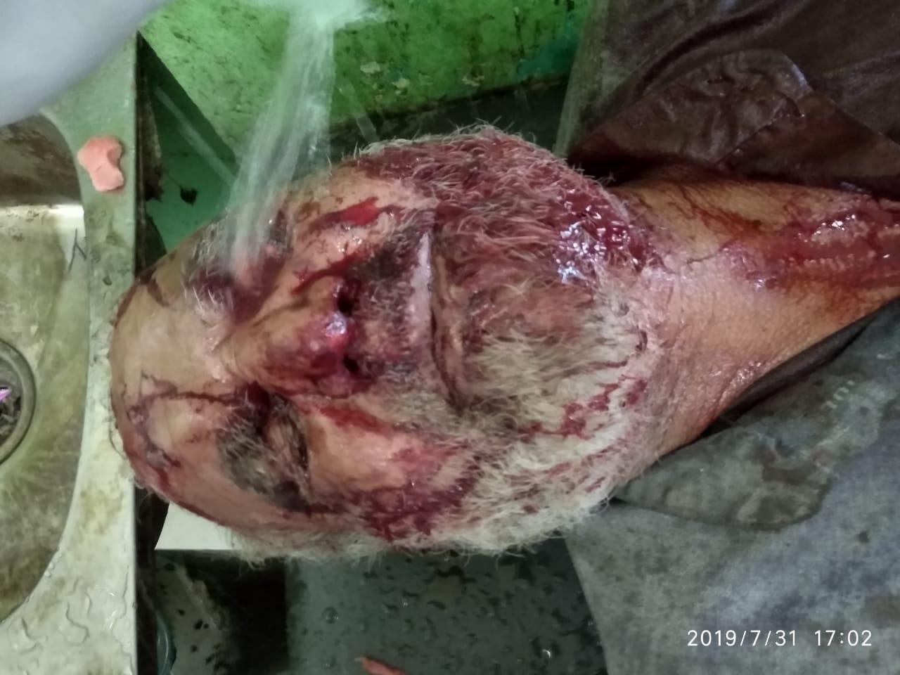 Man injured in bear attack in Handwara village