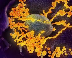 Kashmir reports 2nd COVID-19 death as 62-year-old man with coronavirus dies