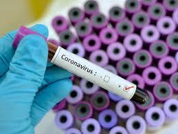 COVID 19: 5 more tests postive in Uri, including three children